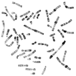 cytogenetics / karyotyping