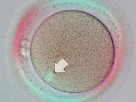 Nikon Advanced Modulation Contrast (NAMC) observation